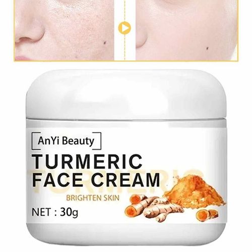 Crème Pour Le Visage Au Curcuma Naturel, Éclaircissante Pour La Peau, Crème De Gratitude, Dissolvant De Taches Foncées, Soins De La Peau Du Visage 