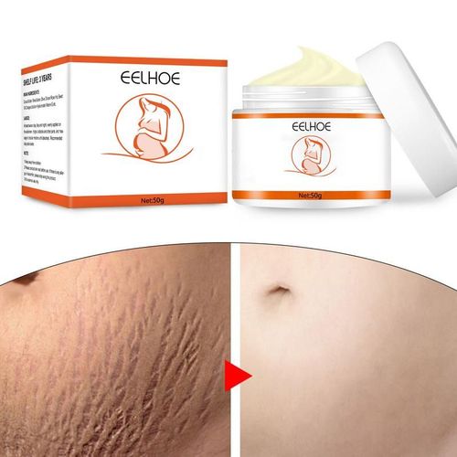 Altercommisted-Crème De Prévention Des Marques Pour Femmes Enceintes, Crème Réparatrice De La Peau, Dissolvant De Marques, Tout Naturel, Corps 03/ 
