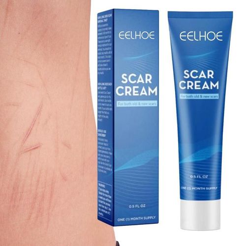 Cicatrice Enlever Gel Gel De Cicatrice Pour Brûlures Dissolvant De Cicatrice Gel Anciens Et Nouveaux Cicatrice Crème 0.5 Fl. Oz ? Crème De Soin Pour La Peau, Pour Le Visage, Les Brûlures, Les Cicatric 
