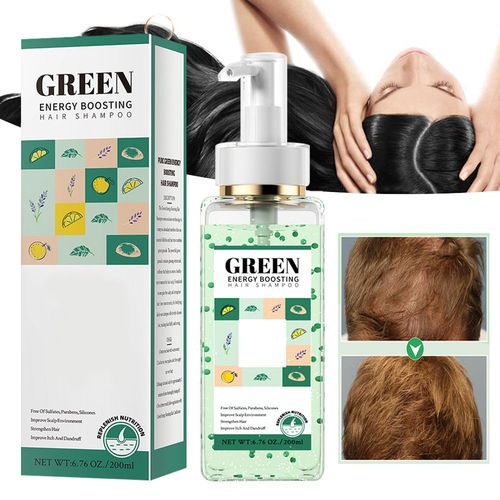 Shampooing Contre La Perte De Cheveux, Traitement Du Cuir Chevelu, Réparation Des Dommages Secs, Cadeau Parfait, Léger, Contrôle De L'huile, Nourrissant 
