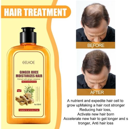 Shampooing Vidéo Anti-Chute De Cheveux, Calvitie Et Pelliculaire, Hydrate Et Répare Activement Les Soins Capillaires, Croissance Optique, 100ml 