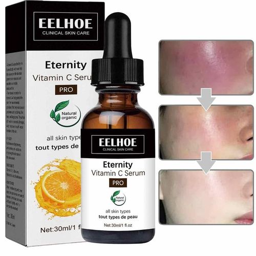 Sérum Anti-Âge À La Vitamine C Pour Le Visage, 30ml, Acide Hyaluronique, Dissolvant De Taches Foncées, Produits De Soins Coréens Pour La Peau 