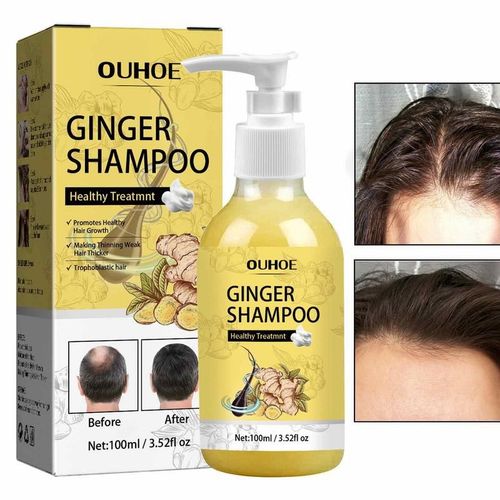 Shampooing Vidéo Pour La Repousse Des Cheveux, Produit Anti-Chute De Cheveux, Croissance Rapide Dense, Thunicef, 100ml 