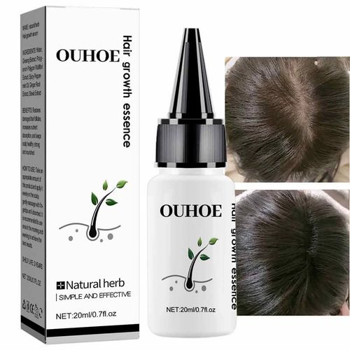 Produits Naturels À Base D'herbes Pour La Croissance Des Cheveux, Anti-Chute, Traitement Contre La Calvitie, Essence À Croissance Rapide, Soins Pour Cheveux Secs Et Abîmés 