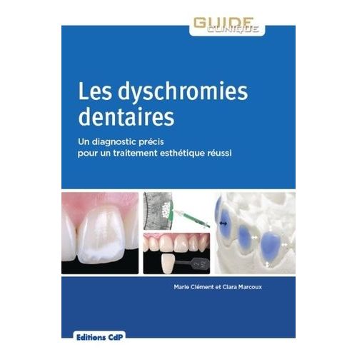 Les Dyschromies Dentaires - Un Diagnostic Précis Pour Un Traitement Esthétique Réussi