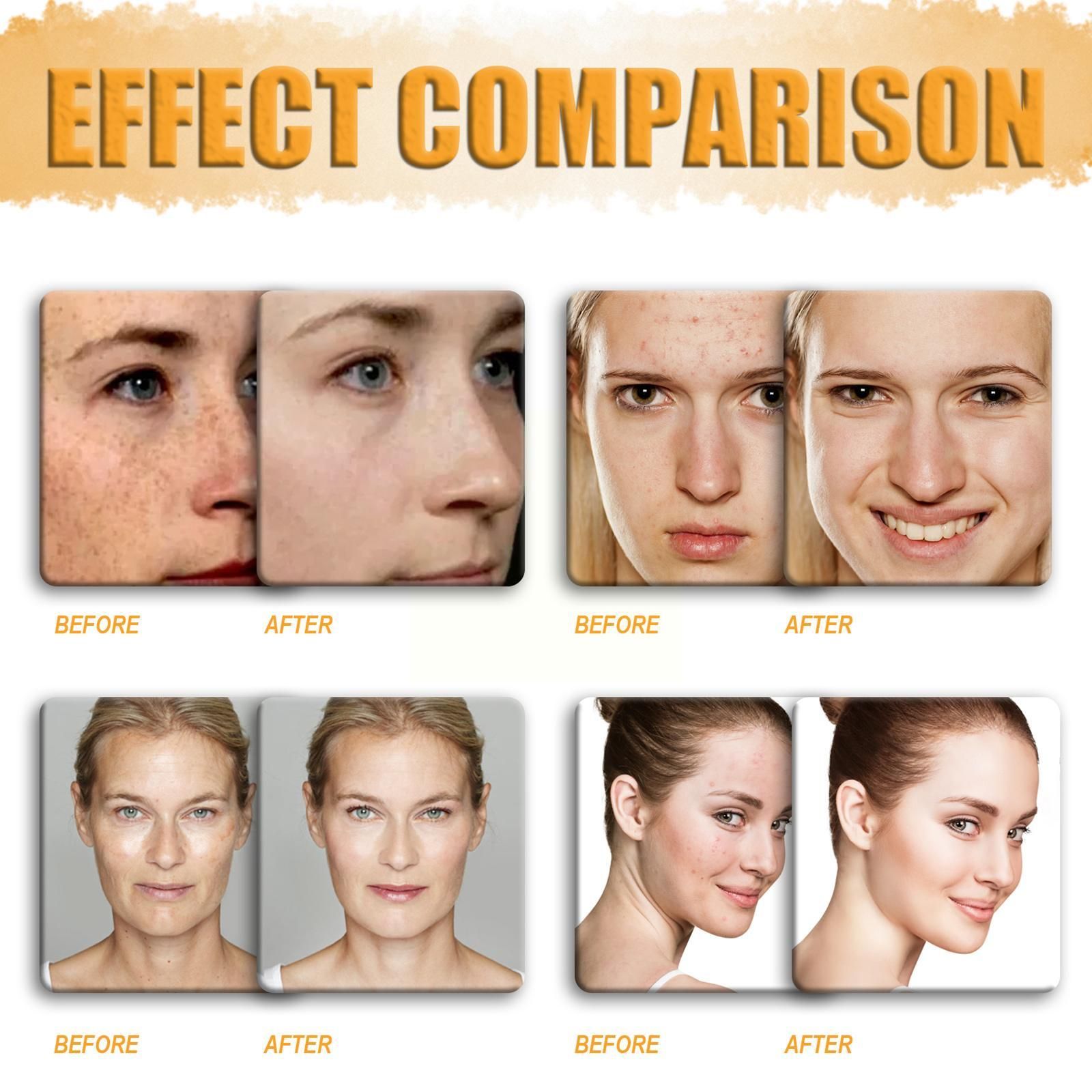 Savon claircissant Pour Le Visage  L'acide 100g Hydratant ... - 2