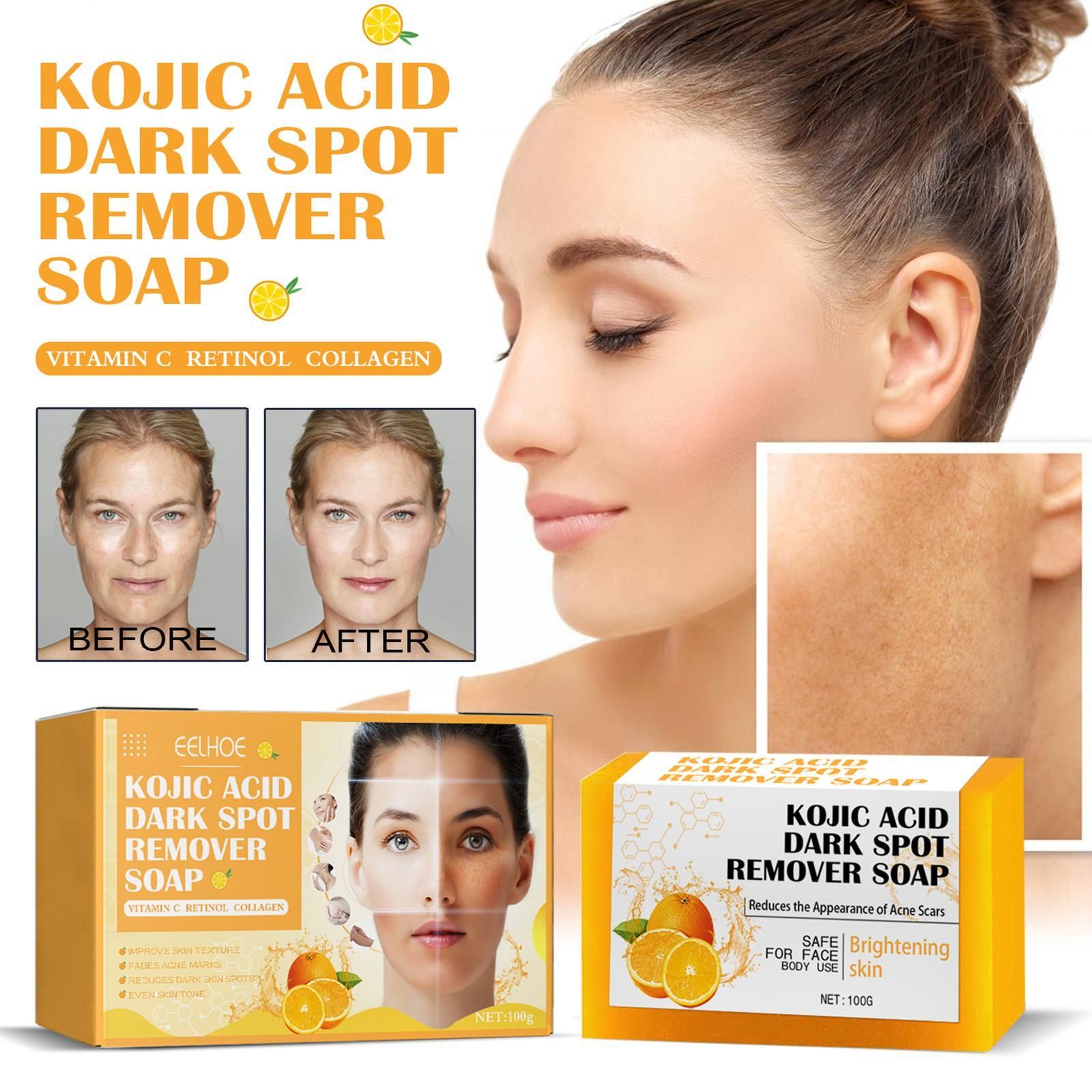 Savon claircissant Pour Le Visage  L'acide 100g Hydratant ... - 4