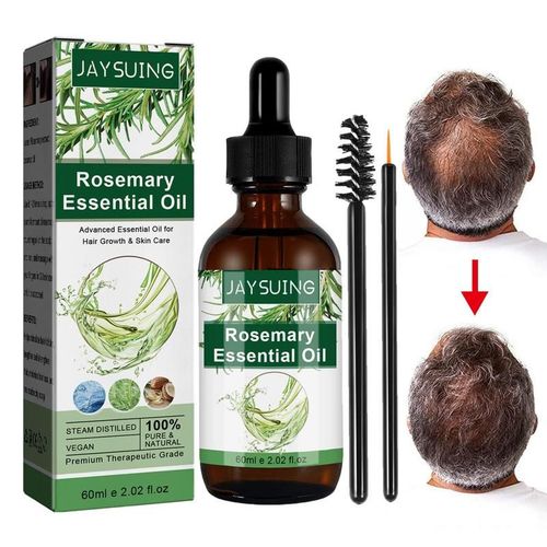Huile De Romarin Relabels Ing, Château Essentiel Pour La Croissance Des Cheveux, La Perte De Cheveux, Nourrit Le Cuir Chevelu Et La Peau Sèche, Optique, Soins Des Cheveux Et De La Peau, 60ml 