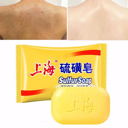Savon Au Soufre Pour Le Bain, Contrôle De L'acné Et De L'huile, Anti-Champignon, Blanchissant, Bon Marché, Sain, Eczéma 