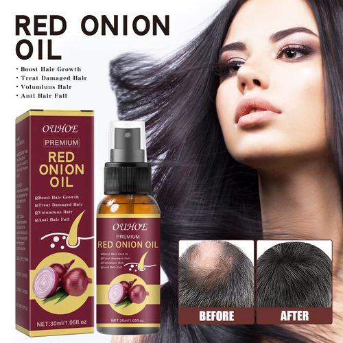 Huiles Essentielles En Spray Pour La Croissance Des Cheveux, 100% Naturels, Traitement Anti Alopécie, Croissance Rapide, Nourrissant, Soins Pour Les Cheveux Secs, Prévention Des Blessures 