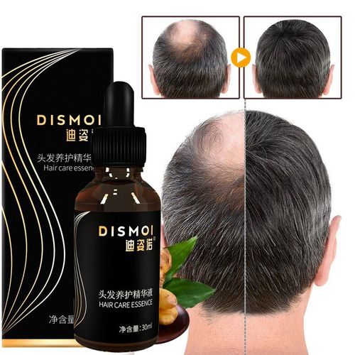 Sérum Pour La Croissance Des Cheveux, Produit Pour Soins, Huile, Perte De Cheveux, Liquide, Traitement Du Cuir Chevelu, Dense 