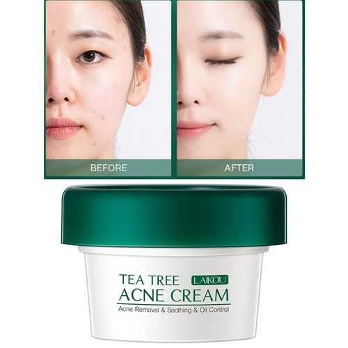 Crème De Traitement Pour Le Visage, Anti-Acné, Dissolvant De Cicatrice, Hydratant, Apaisant, Contrôle Du Sébum, Soins Pour La Peau, Blanchissante 
