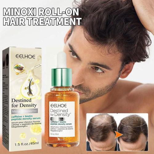 De Croissance De Cheveux De Gingembre Huile Essentielle Naturelle Anti Cheveux Produits Barbe Prévenir Traitement Des Cheveux Endommagés Calvitie Soins Perte Sèche Sca A8c6 