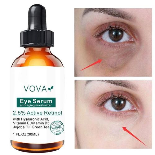 Crème Hydratante Pour Les Yeux, Anti-Boursouflure, Anti-Cernes, Soin Éclaircissant Pour Les Yeux, Raffermissant Pour La Peau 