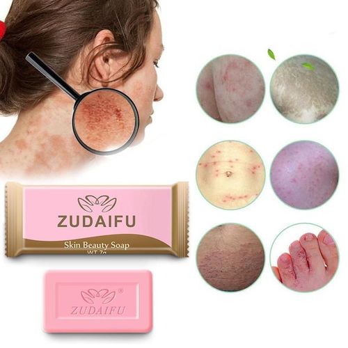 Savon Au Mini-Soufre Pour La Peau, 2 Pièces, Shampoing, Anti-Acné, Avirus, Séborrhée, Eczéma, Anti-Champignon, Bain, Blanchissant 