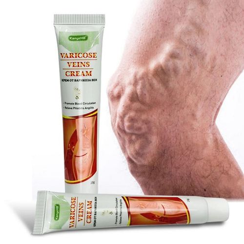 Crème D'élimination Des Varices Et Des Veines D'araignée, Dissolvant Pour Les Jambes Et Le Scrotum Génital, 20g 