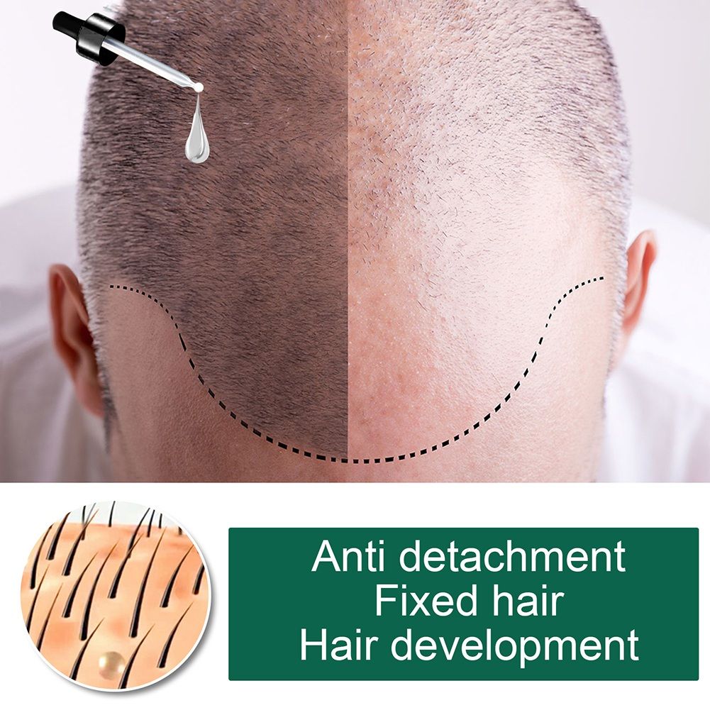 Solution Nutritive Aux Huiles Essentielles Pour Cheveux, Soi... - 4