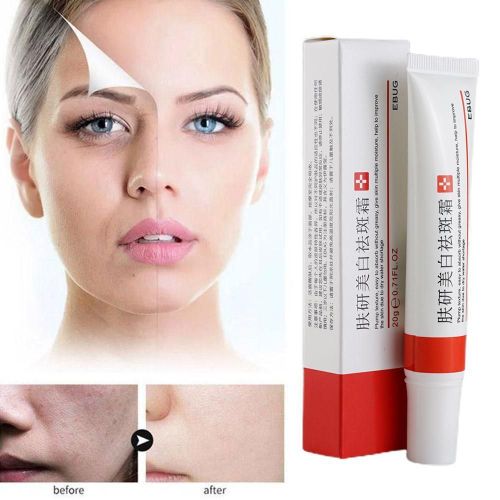 Sérum Dissolvant De Points Noirs, 20g, Essence De Nettoyage En Profondeur, Resserre Les Pores, Crème De Soins Pour La Peau, Gel Hydratant Blanchissant Pour Le Visage 