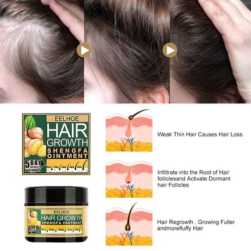 Crème Contre La Perte De Cheveux, Soin Pour La Croissance Des Cheveux, Favorise La Croissance Des Follicules Pileux, Améliore L'environnement Du Cuir Chevelu, Revitalisant Hydratant 