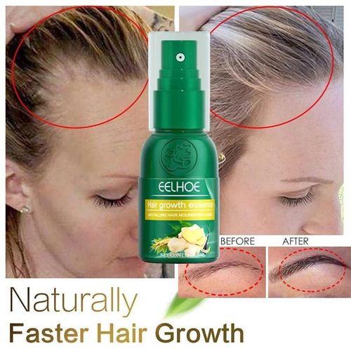 Spray De Croissance Capillaire Au Gingembre, 30ml, Massage Du Cuir Chevelu, Hydratant, Soin Dense, Réparation Des Cheveux Secs, Spray De Nutrition, Anti-Chute 