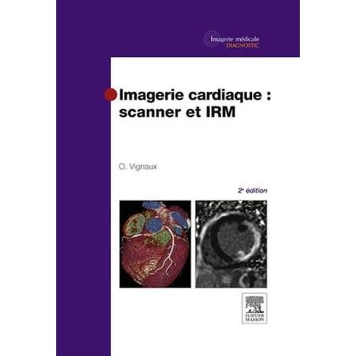 Imagerie Cardiaque : Scanner Et Irm