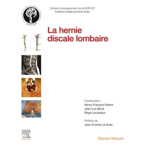 La Hernie Discale Lombaire
