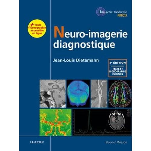 Neuro-Imagerie Diagnostique