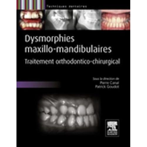 Dysmorphies Maxillo-Mandibulaires