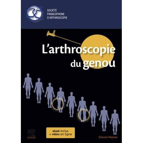 L'arthroscopie Du Genou