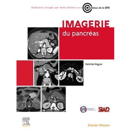 Imagerie Du Pancréas