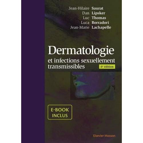 Dermatologie Et Infections Sexuellement Transmissibles