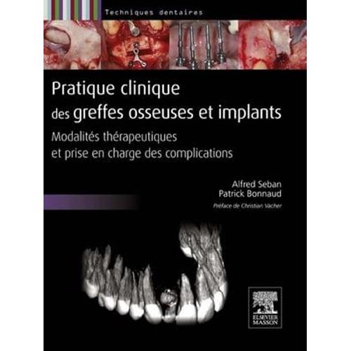 Pratique Clinique Des Greffes Osseuses Et Implants