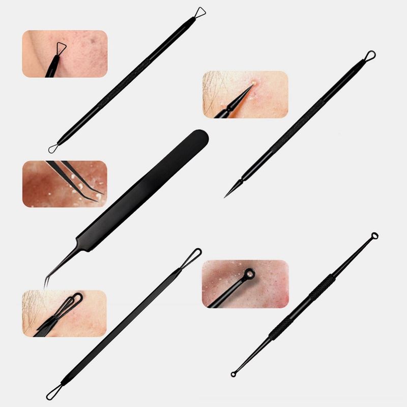 Dissolvant De Points Noirs, Kit D'outils D'extraction De Bou... - 3