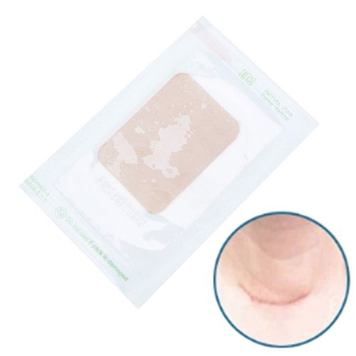 Feuille De Gel De Silicone Pour Traitement Thérapeutique Des Cicatrices, 7styles, Élimination Des Marques De Blessures, Césarienne, Chéloïdes 