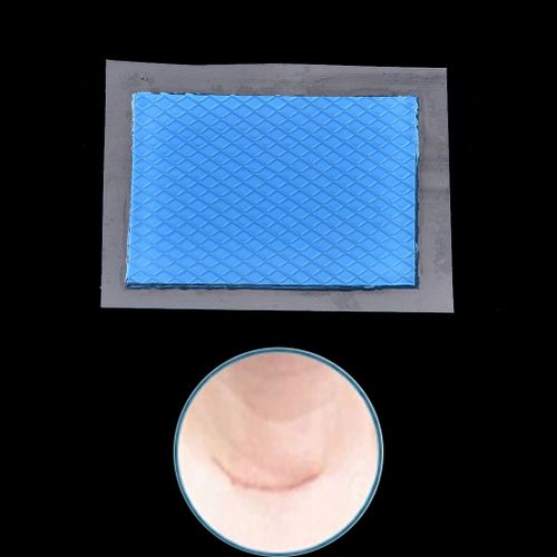 Feuille De Gel De Silicone Pour Traitement Thérapeutique Des Cicatrices, 7styles, Élimination Des Marques De Blessures, Césarienne, Chéloïdes 