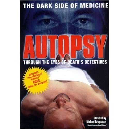 Autopsie