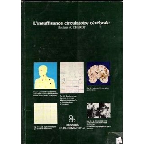 L Insuffisance Circulatoire Cerebrale