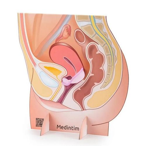 Représentation De L'appareil Génital Féminin Avec Un Diaphragme En Carton | Medintim