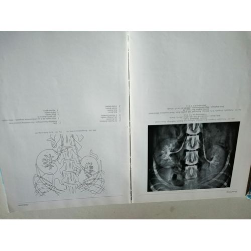 Atlas D'anatomie Topographique Des Animaux Domestiques:3 Volumes , Popesko