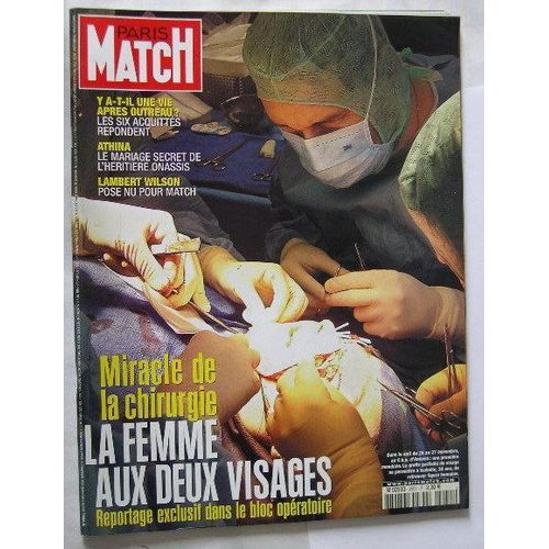 Paris  Match N° 2951 : La  Femme  Aux  Deux  Visages