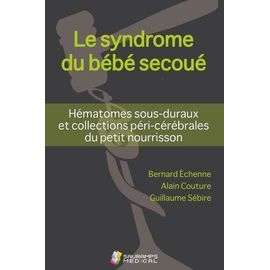 Le Syndrome Du Bébé Secoué - Hématomes Sous-Duraux Et Collections Péri-Cérébrales Du Petit Nourrisson