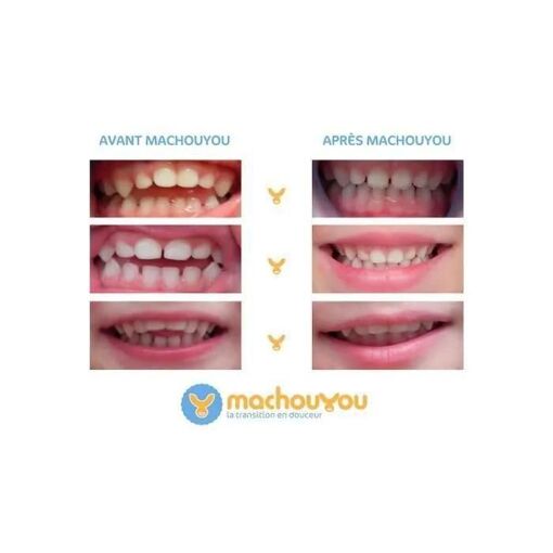 Machouyou Dispositif 1ere Dentition - 3
