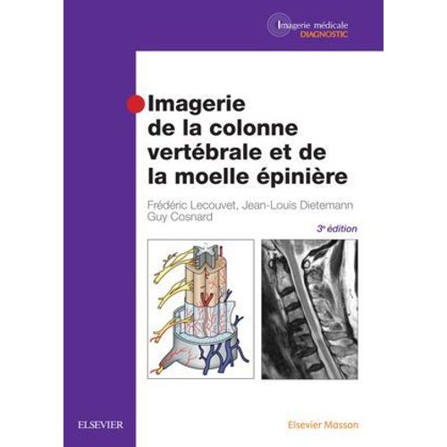 Imagerie De La Colonne Vertébrale Et De La Moelle Épinière