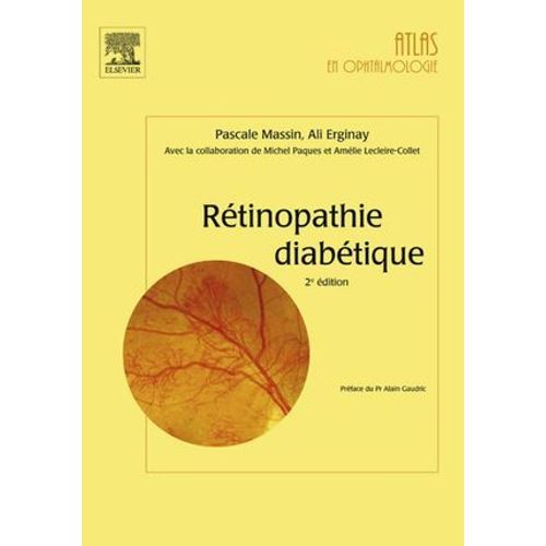 Rétinopathie Diabétique
