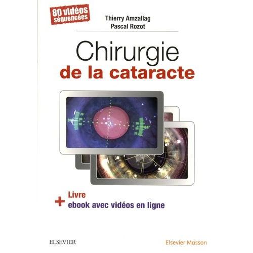 Chirurgie De La Cataracte