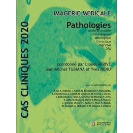 Imagerie Médicale - Pathologies Ostéo-Articulaire, Neurologique, Sénologique, Thoracique, Digestive, Orl