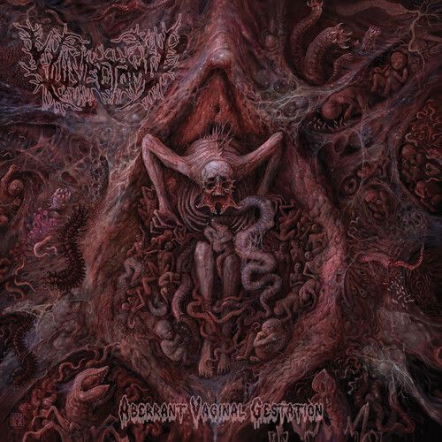Vulvectomy - Aberrant Vaginal Gestation [Compact Discs]