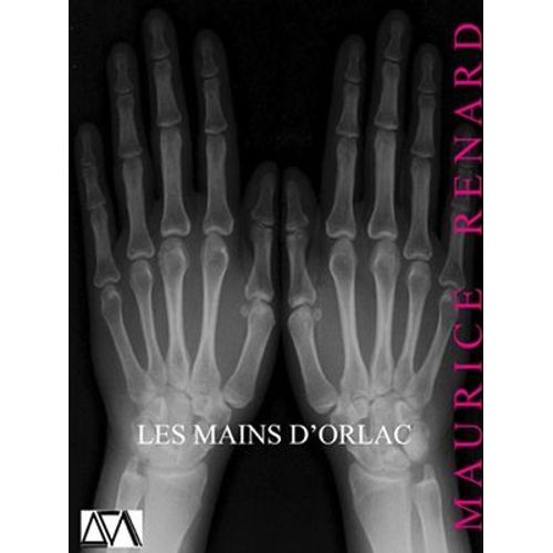 Les Mains D'orlac