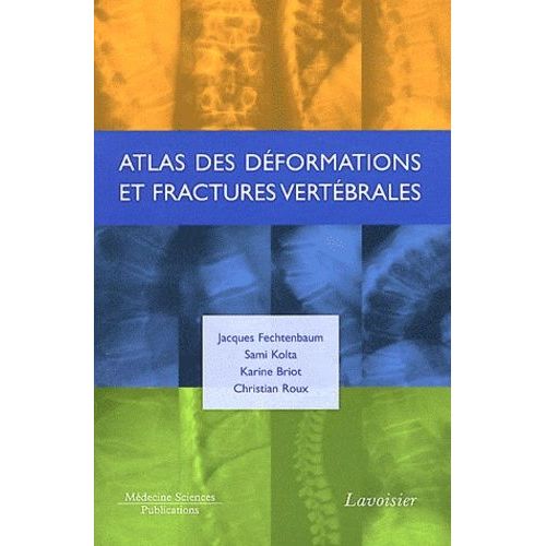 Atlas Des Déformations Et Fractures Vertébrales