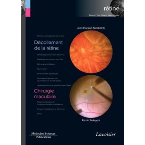 Rétine - Volume 6, Décollement De La Rétine - Chirurgie Maculaire